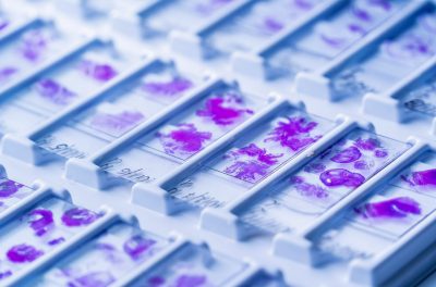 Close-up view of multiple microscope slides arranged in a tray, each displaying stained biological samples in vivid shades of purple.