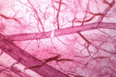 Micrograph of a capillary showing a network of blood vessels filled with red blood cells.