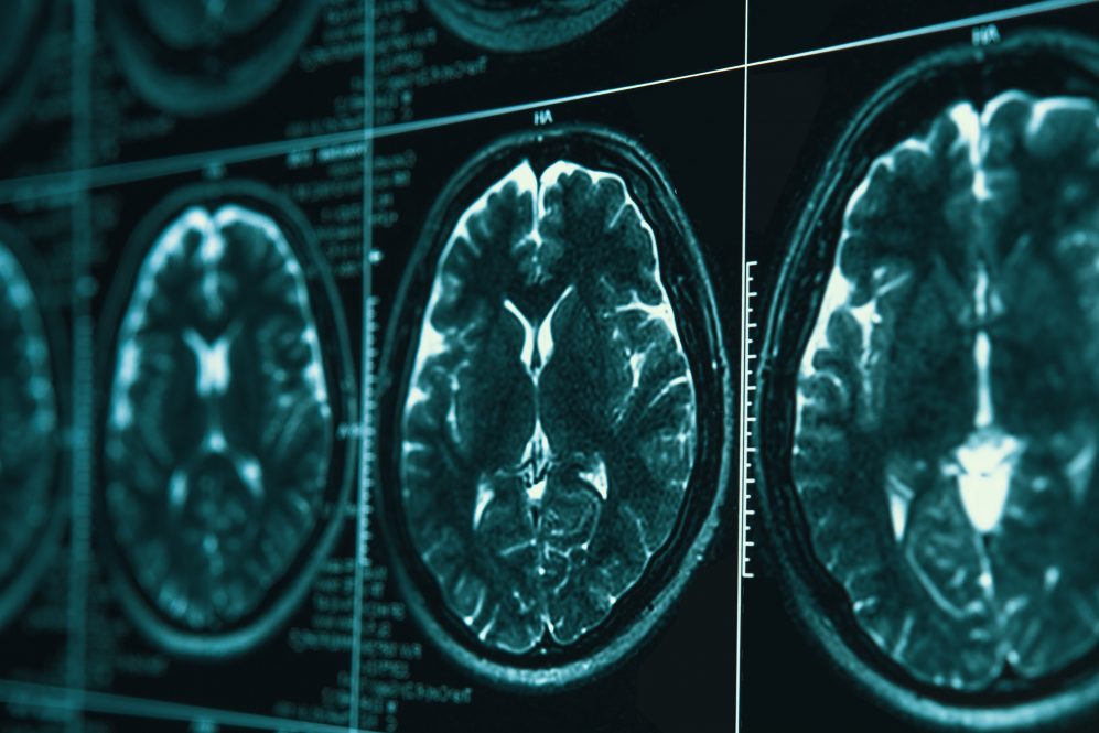 MRI scans of a human brain. (Adobe Stock)